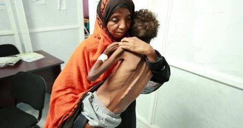 وباء الكوليرا يخرج عن السيطرة في اليمن
