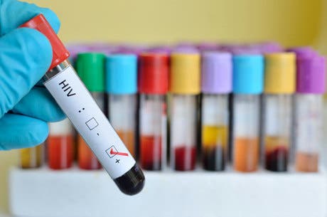 علماء يتوصلون إلى مكان اختباء فيروس الإيدز في الجسم