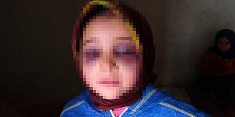 اعتقال أستاذ تارودانت المتهم بتعنيف الطفلة مريم