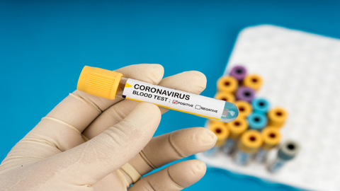تسجيل ثاني حالة إصابة مؤكدة بفيروس كورونا في تونس