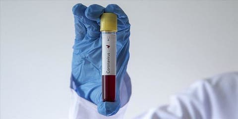 تسجيل أول حالة إصابة بفيروس “كورونا” في مكة المكرمة