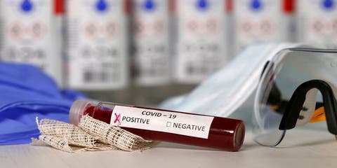 بلجيكا .. تسجيل 1422 إصابة جديدة بفيروس كورونا