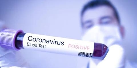 ألمانيا .. تسجيل 215 وفاة جديدة بفيروس كورونا