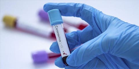 أكادير : إكتشاف إصابة سائحة بولونية بفيروس ” كورونا”