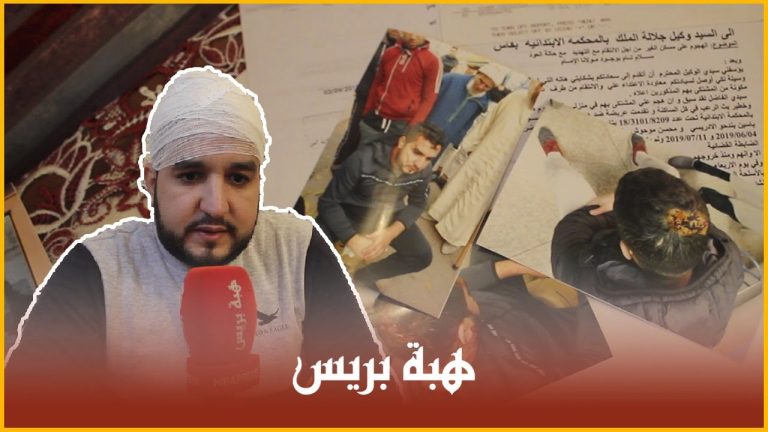 بعد إخباره شرطة فاس عن مجرم خطير ..أصدقاء المجرم يتهجمون بالعصي والأسلحة البيضاء على المُبلِغ
