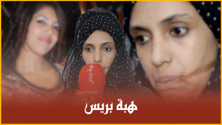 إلهام.. سيدة عنفها زوجها بالسلاح الأبيض وشوه وجهها تُناشد المحسنين