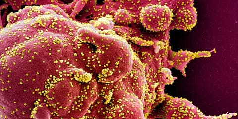 الصحة العالمية: عدوى فيروس كورونا قد تتحول إلى مرض جهازي
