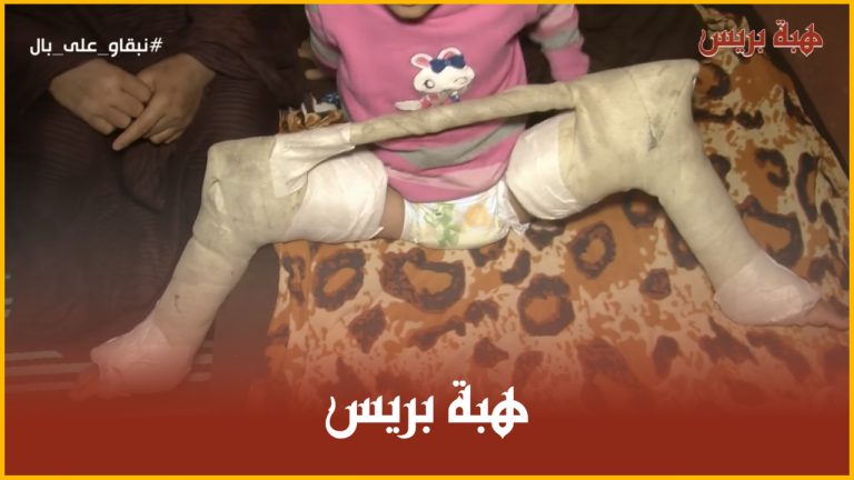 معاناة طفلتان توأم مع الإعاقة .. والأم تناشد المحسنين مساعدة ابنتيها