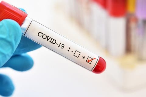 بريطانيا توافق على تجارب لإصابة الأشخاص عمدا بفيروس كورونا