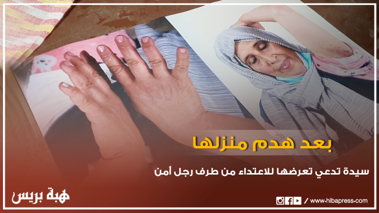 سيدة تدعي تعرضها للإعتداء والعنف من طرف رجل أمن