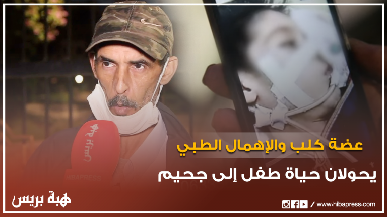 ﻋﻀﺔ ﻛﻠﺐ ﻭﺍﻹﻫﻤﺎﻝ ﺍﻟﻄﺒﻲ ﻳﺤﻮﻻﻥ ﺣﻴﺎﺓ ﻃﻔﻞ ﺇﻟﻰ ﺟﺤﻴﻢ