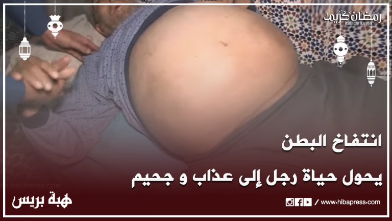 انتفاخ البطن يُحول حياة رجل إلى عذاب وجحيم