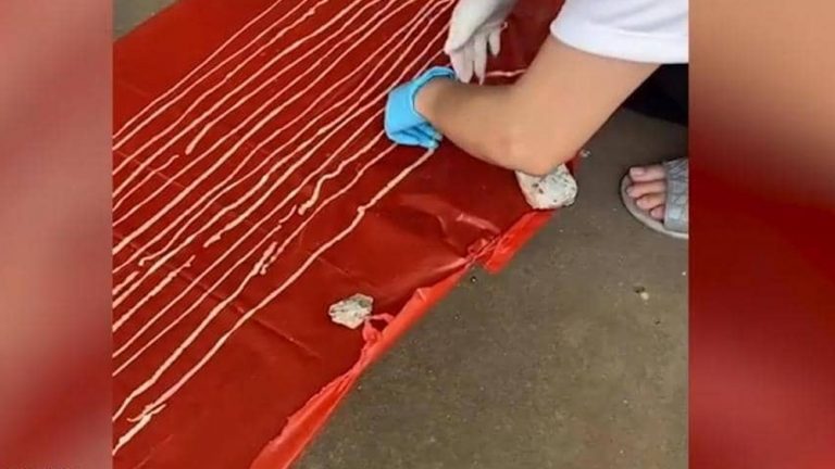أطباء ينجحون في إنقاذ مريض من "دودة عملاقة"