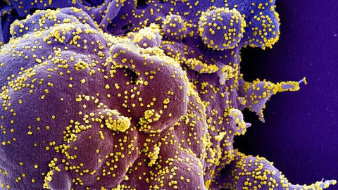 الصحة العالمية تحدد 4 نسخ من فيروس كورونا "تثير قلقا خاصا"