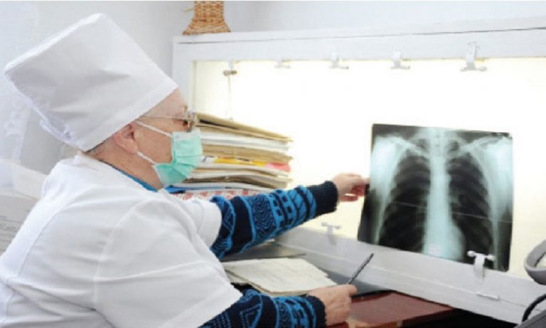 "الصحة العالمية" تدق ناقوس الخطر: ارتفاع وفيات داء السل لأول مرة منذ عقد