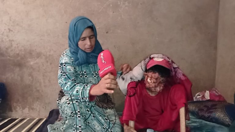بعد أن نهشها المرض 17 سنة بسطات.. الطفلة "حنان" تغادر في صمت " فيديو"