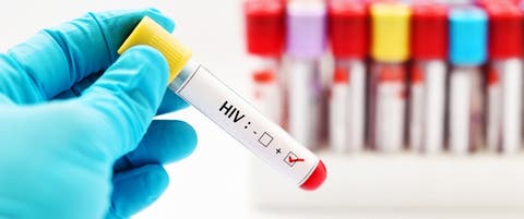 الأمم المتحدة: كورونا قد يسبب زيادة الإصابات بالإيدز في افريقيا