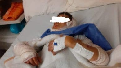 Photo of وجدة .. عضات كلبين تصيب طفلا بجروح غائرة