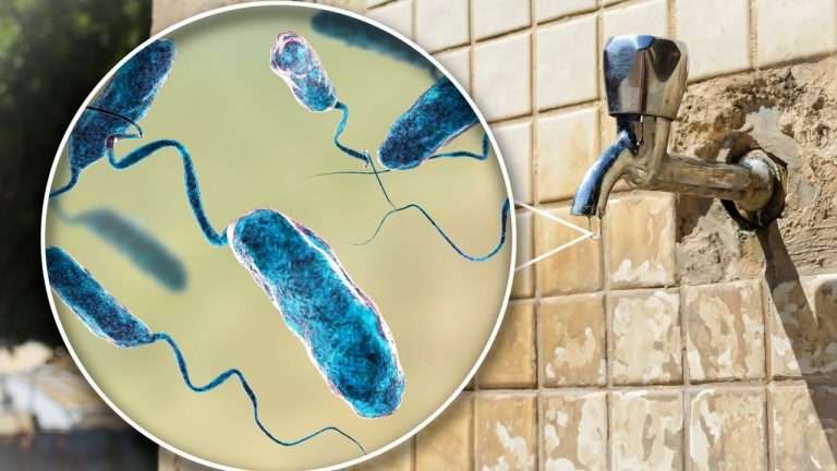 إسبانيا تعلن تسجيل حالة إصابة بالكوليرا