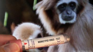 Photo of الصحة العالمية: إصابات جدري القرود في العالم ترتفع بـ 20%