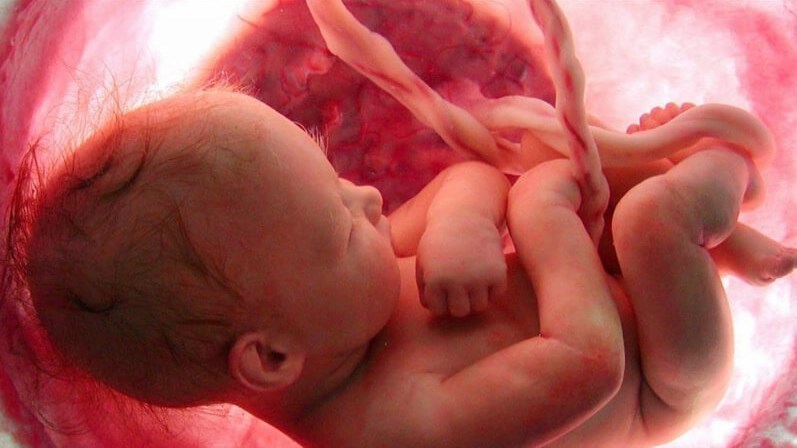 فرنسا.. جراحة ناجحة لمخ جنين داخل رحم أمه
