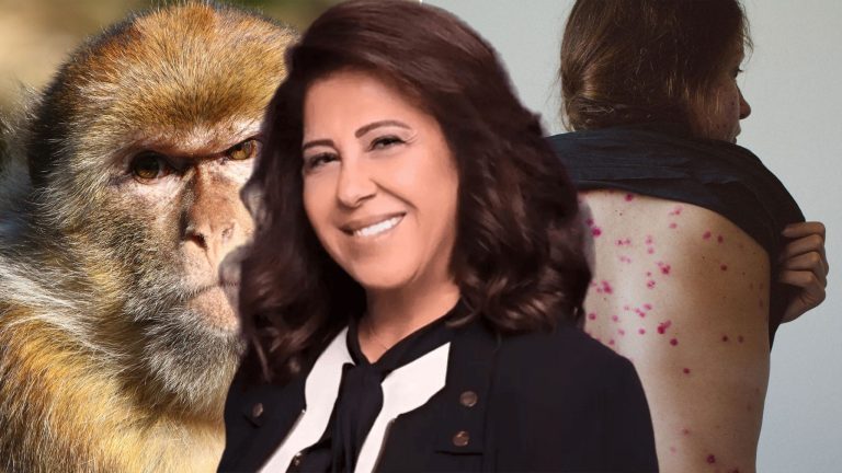 جدري القردة .. ليلى عبداللطيف