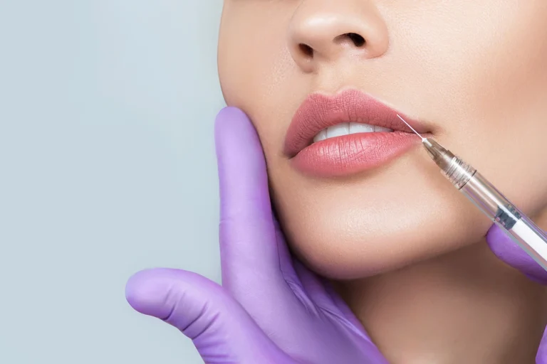 "الأطفال يخافون منها".. رجل طلب تطليق زوجته بسبب "الفيلر"