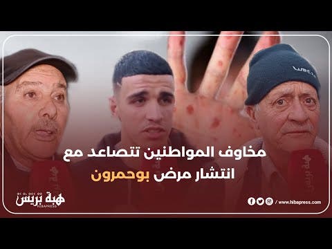 مخاوف المواطنين تتصاعد مع إنتشار مرض بوحمرون: قلق ومطالب بالتدخل