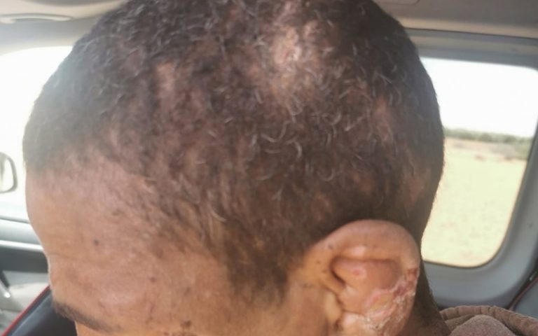على طريقة حياة الماعز.. اعتقال أب وابنه بتهمة احتجاز رجل داخل ضيعة بمراكش(صور)