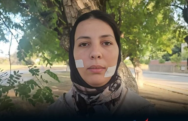 سنتان ونصف سجناً للمتهم بتشويه وجه خديجة