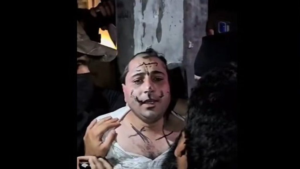 تعذيب فنان شعبي يثير موجة غضب واسعة في سوريا (فيديو)