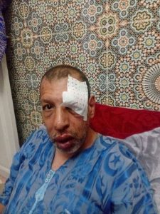 تارودانت.. اعتداء شنيع على شخص من ذوي الاحتياجات الخاصة يثير موجة من الغضب(صورة)
