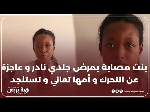 بنت مصابة بمرض جلدي نادر و عاجزة عن التحرك و أمها تعاني و تستنجد