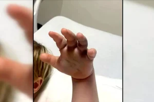 غضب واسع بعد إصابة طفل بلدغة أفعى في حضانة (صورة)