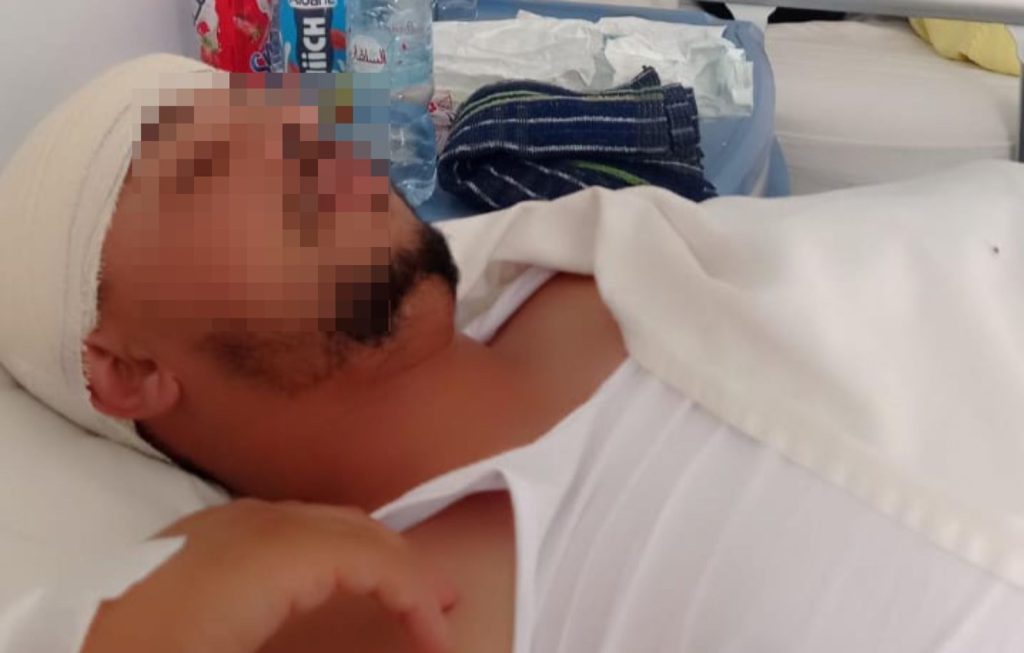سيدي محمد الحمر.. ضحية اعتداء يكشف معاناته بعد حكم قضائي أثار الجدل