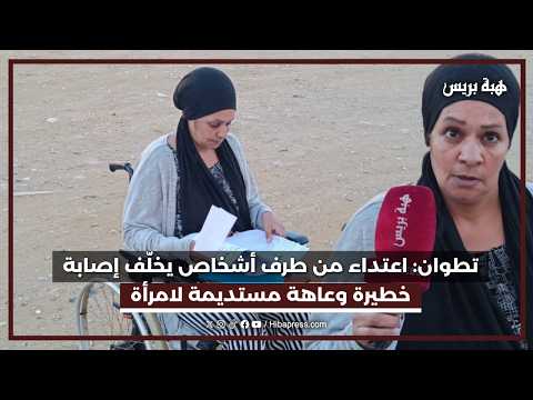 تطوان: اعتداء من طرف أشخاص يخلّف إصابة خطيرة وعاهة مستديمة لامرأة
