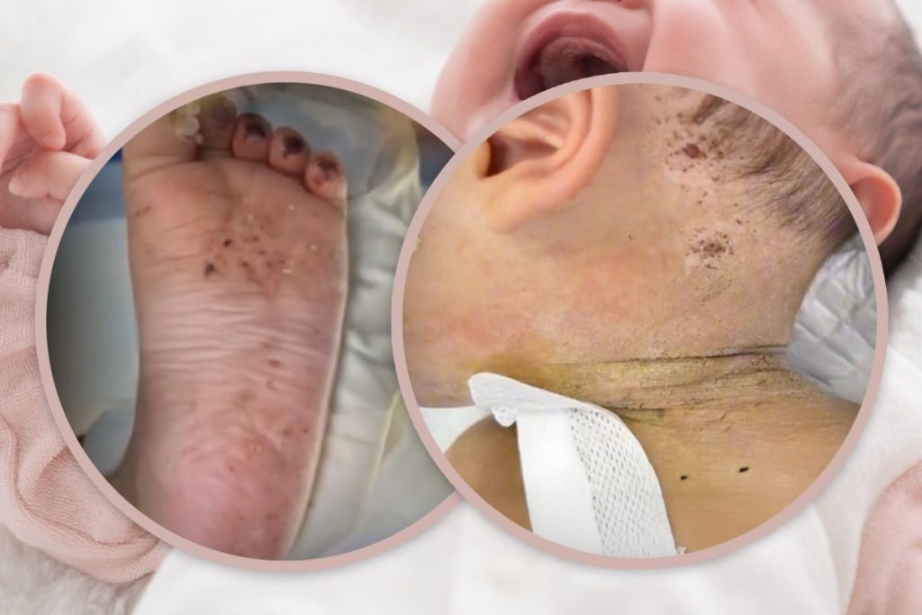 واقعة صادمة.. أم تُخضع رضيعها لممارسات مؤذية بدعوى العلاج (صور)