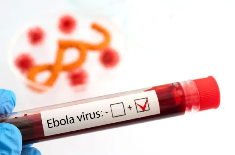 الكونغو يعلن ارتفاع الإصابات بفيروس إيبولا إلى 1028 حالة