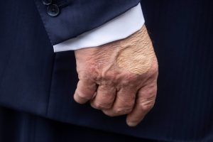 صور يد ترامب تثير جدلاً جديداً حول وضعه الصحي