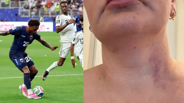 قائد الرأس الأخضر يواجه تهمة اغتصاب مترجمة المنتخب في المونديال