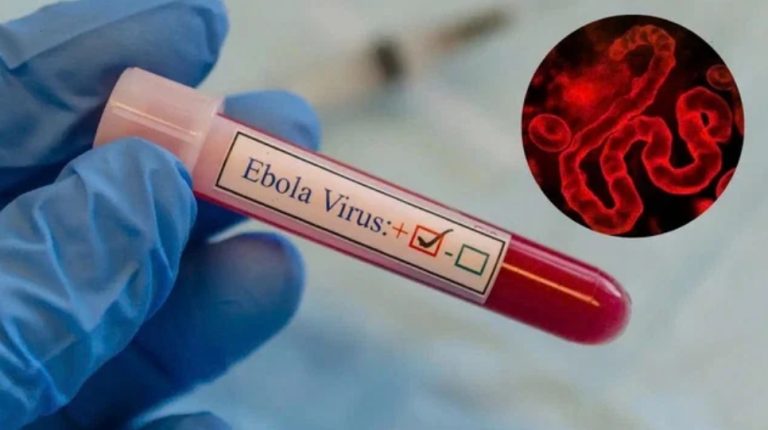 مراكش.. مصدر يكشف حقيقة إصابة مواطن إفريقي بفيروس إيبولا