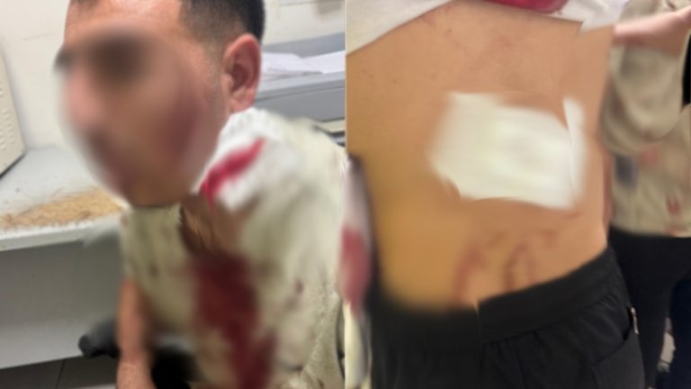 اعتداء خطير بالبرنوصي.. عصابة مدججة بالأسلحة البيضاء تهاجم مستخدمي محل تجاري