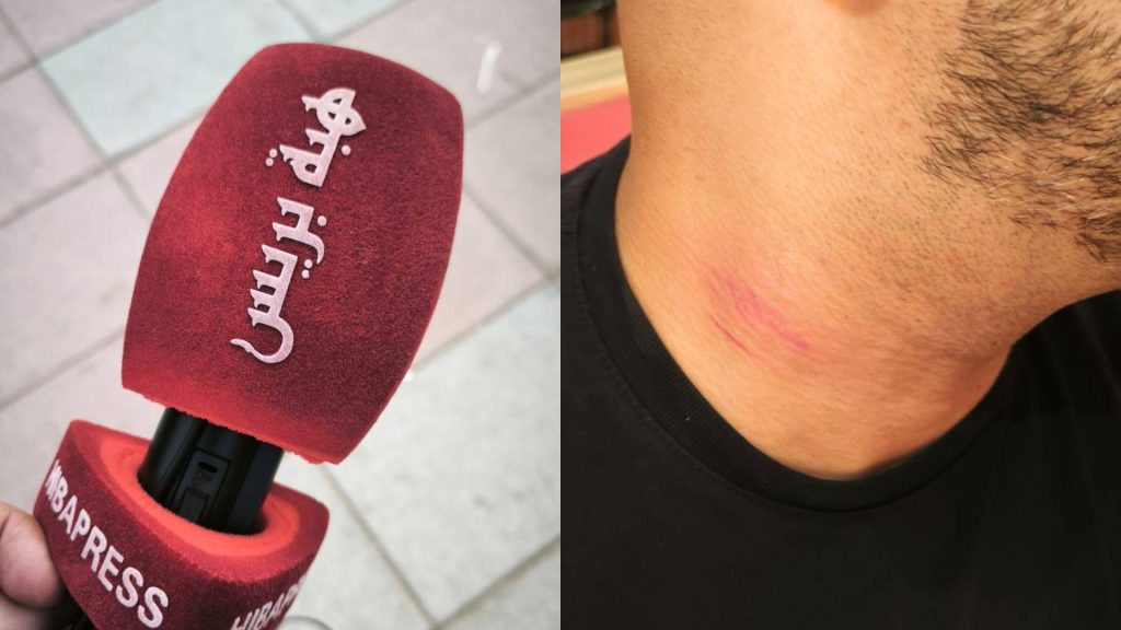 سبتة المحتلة.. الشرطة الإسبانية تعتدي على مراسل هبة بريس أثناء أداء مهامه