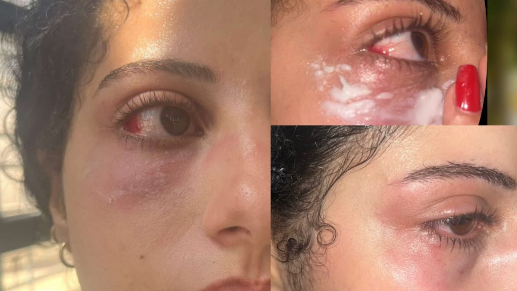 ‎القصر الكبير.. فتاتان تكشفان تفاصيل اعتداء وسرقة بعد رفضهما التحرش