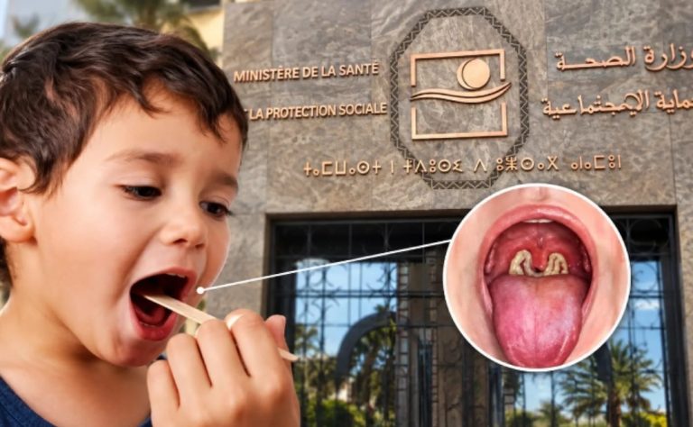 أطباء وخبراء يحذرون من عودة الدفتيريا ويدعون إلى تعزيز التلقيح والتواصل الصحي