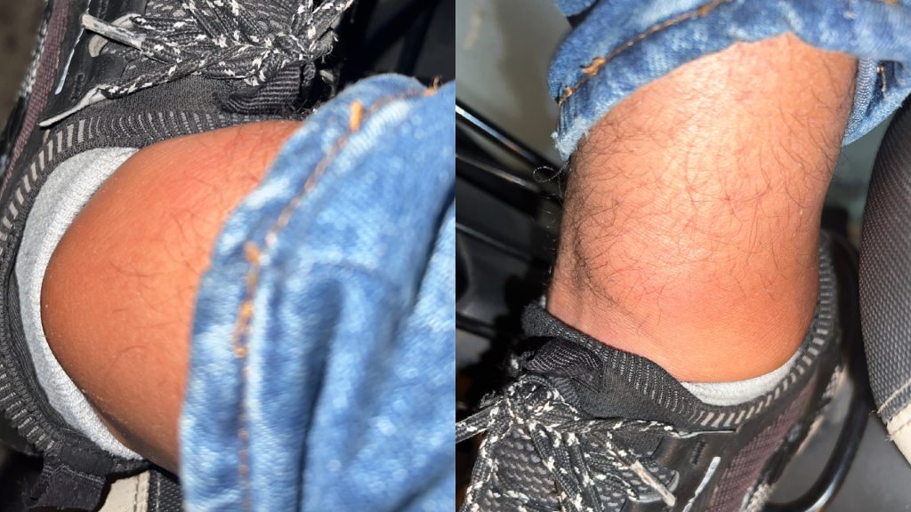 ساكنة طنجة تشتكي من غزو «الشنيولة».. ومطالب بتدخل عاجل