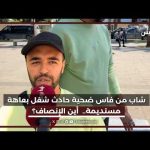 حادثة شغل تقلب حياة شاب من فاس، تسببت له بعاهة مستديمة بيده